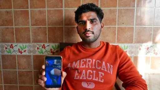 Ramjan Rath, who survived a Jan. 17, 2022, Houthi attack on a fuel depot shows an image from the hospital of his dressed wounds after the attack in Abu Dhabi, United Arab Emirates, Wednesday, Feb. 2, 2022. Workers from India and Pakistan, part of a vast foreign workforce powering the United Arab Emirates' economy, found themselves caught in the crossfire of a wider regional war last month. (AP Photo/Malak Harb)