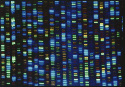 This undated image made available by the National Human Genome Research Institute shows the output from a DNA sequencer. Collectively, about 350 million people worldwide suffer from rare diseases, most of which are genetic. But each of the 7,000 individual disorders affects perhaps a few in a million people or less. So there’s little commercial incentive to develop or bring to market these one-time therapies to fix faulty genes or replace them with healthy ones. (NHGRI via AP, File)