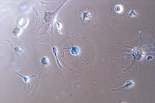 This microscope photo provided by the Mayo Clinic in August 2022 shows senescent myoblast cells. Senescent cells resist apoptosis, or programmed cell death, and characteristically get big and flat, with enlarged nuclei. They release a blend of molecules, some of which can trigger inflammation and harm other cells — and paradoxically also stimulate the growth of malignant cells and fuel cancer, says Mayo Clinic researcher Nathan LeBrasseur. (Dr. Xu Zhang/Mayo Clinic via AP)