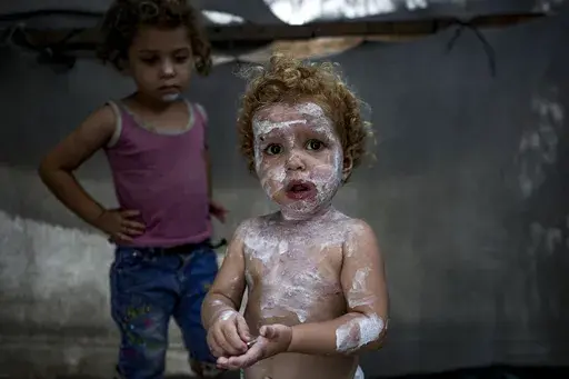 Displaced child Sham al-Hessi, center, who suffers from skin disease, is covered with skin cream as she poses for a picture, at a makeshift tent camp in Deir al-Balah, central Gaza Strip, Monday, July 29, 2024. Skin diseases are running rampant in Gaza, health officials say, from appalling conditions in overcrowded tent camps housing hundreds of thousands of Palestinians driven from their homes. (AP Photo/Abdel Kareem Hana )