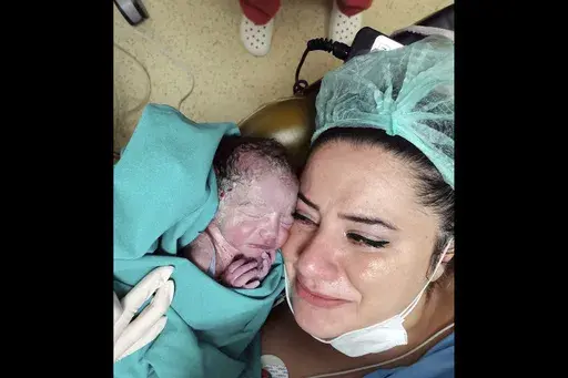 In this photo provided by the Gokdeniz family, Burcu Gokdeniz holds her newborn baby Umut Ali Gokdeniz for the first time moments after the preterm birth in Istanbul, Turkey, Tuesday, Aug. 25, 2020. (Gokdeniz family via AP)